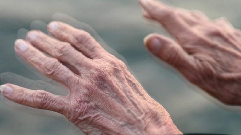 Parkinson: “Compromete al 1% de la población por arriba de 60 años”