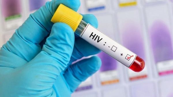 Unas 139 mil personas viven con VIH en Argentina