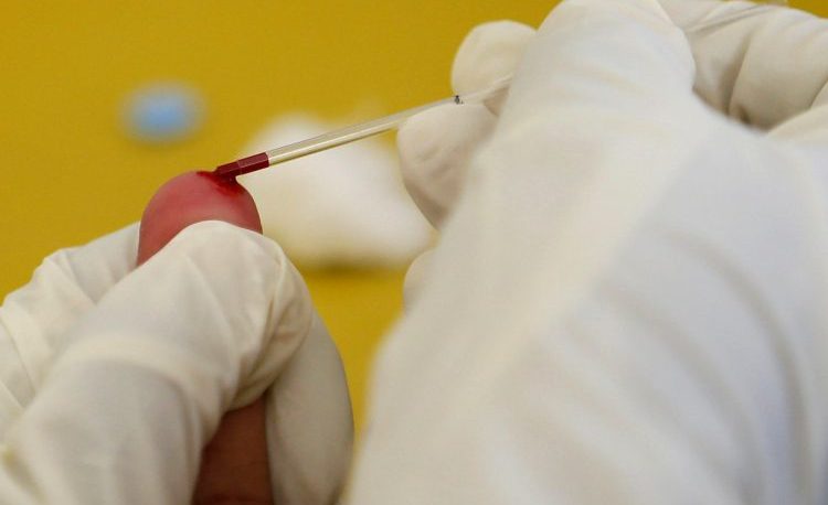 Confirman el segundo caso de curación del VIH en el mundo
