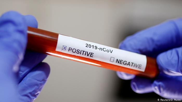 Coronavirus en Misiones: Difunden parte médico del nuevo caso positivo