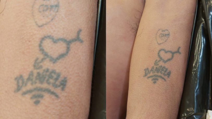 Se filtran imágenes de un tatuaje del hombre ultimado en Parque Adam