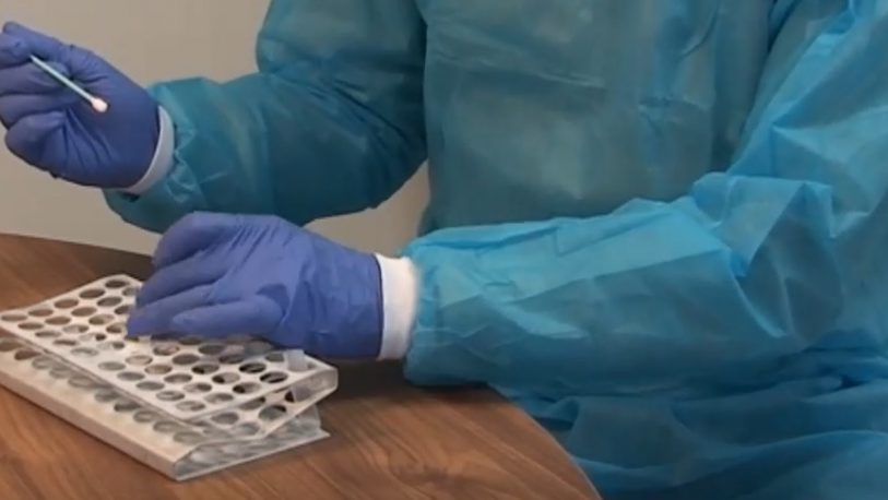 Argentina recibió 215 mil test PCR para el diagnóstico