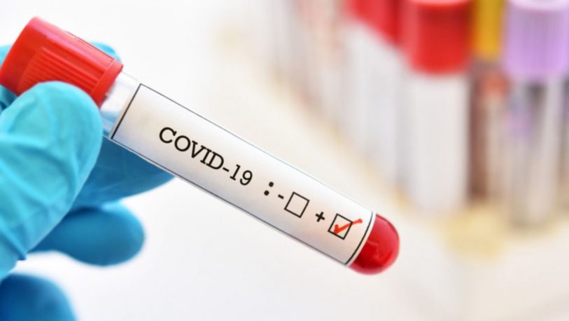 Confirman 4 nuevos casos de coronavirus en Misiones