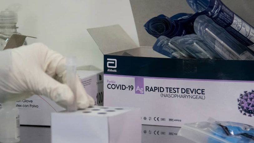 Presentaron un test rápido para detectar coronavirus en 20 minutos