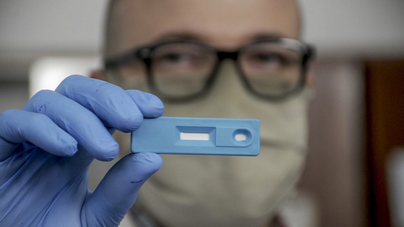 Científicos argentinos crean el primer test que en cinco minutos detecta el coronavirus
