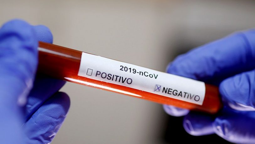 Coronavirus en Misiones: datos oficiales revelan una baja en los contagios