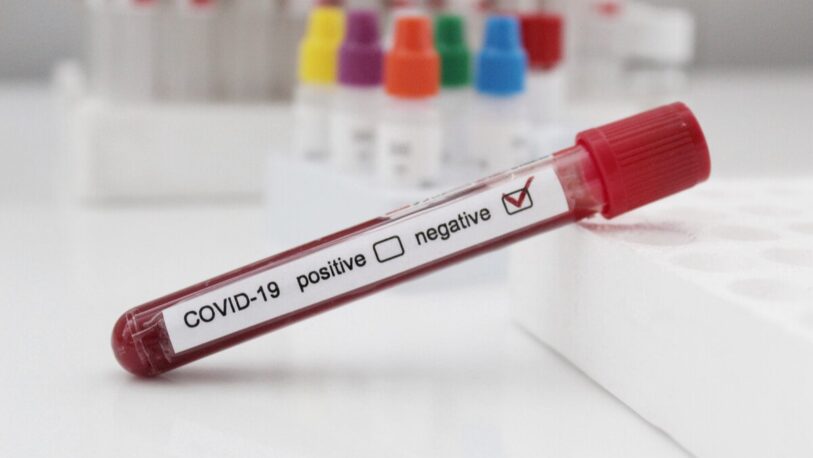 Coronavirus: otros 49 casos en un día y 3 muertos