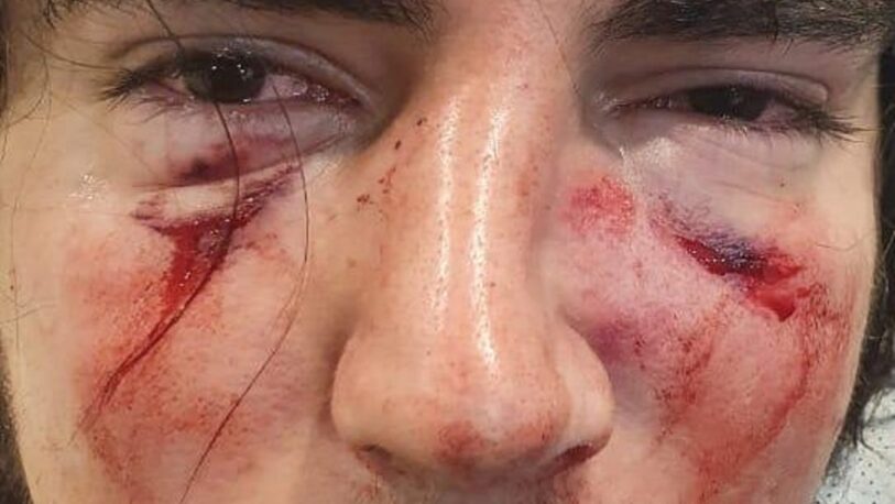 Denuncian a rugbiers por una brutal golpiza en Córdoba