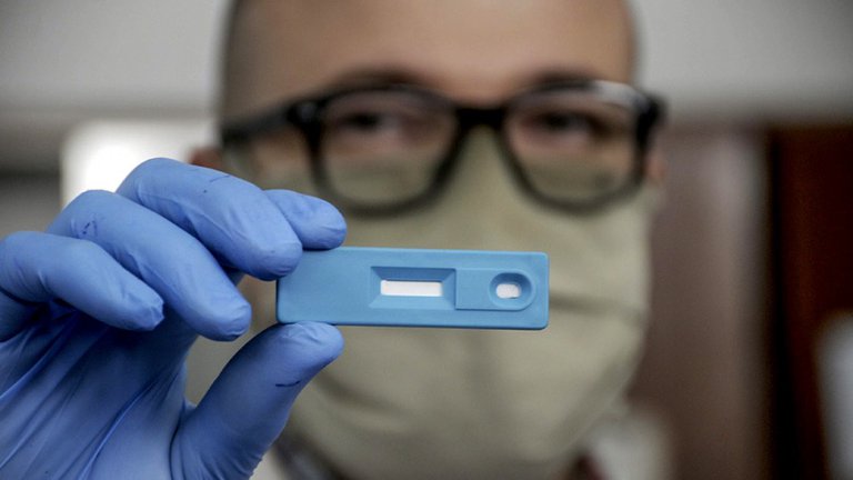 ANMAT: aprobaron el test argentino de detección rápida de coronavirus