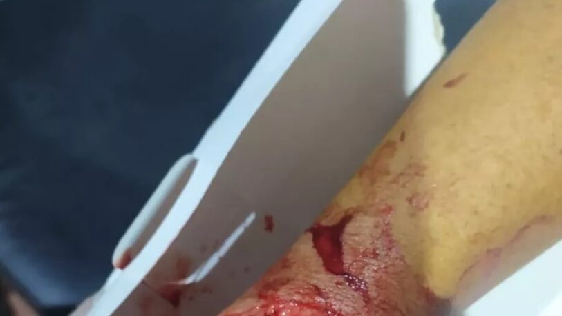 Cazador de “tatú” terminó herido en plena cacería