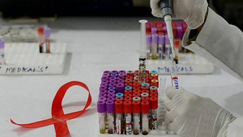 Histórico: una paciente argentina con HIV logró controlar el virus