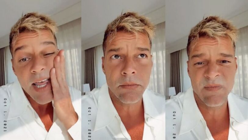 Ricky Martin rompió el silencio sobre su supuesto retoque en la cara