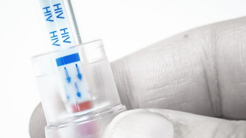 Una vacuna contra el VIH inicia pruebas en humanos