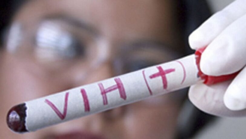 Hallaron una nueva variante más contagiosa y agresiva del VIH