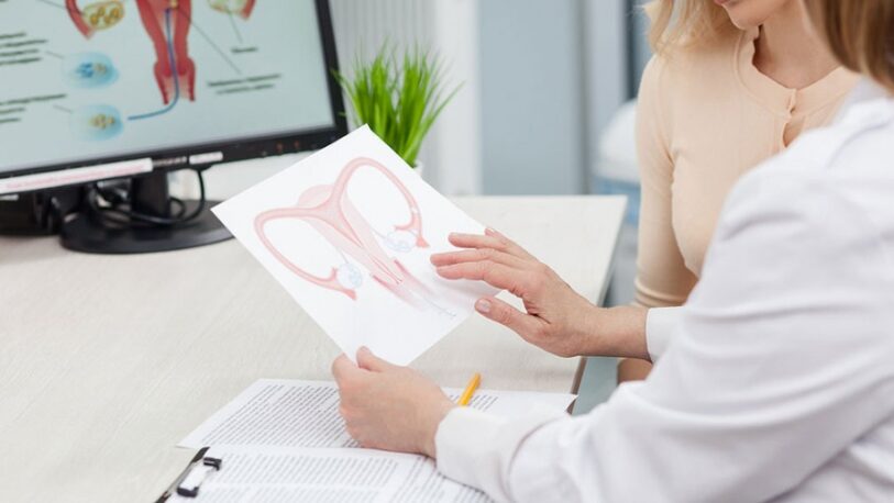 Cáncer de ovario: más del 70% de los casos se detectan en etapa avanzada