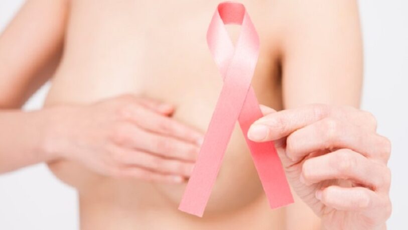 Cáncer de mama: Cinco cosas que podés hacer para prevenirlo