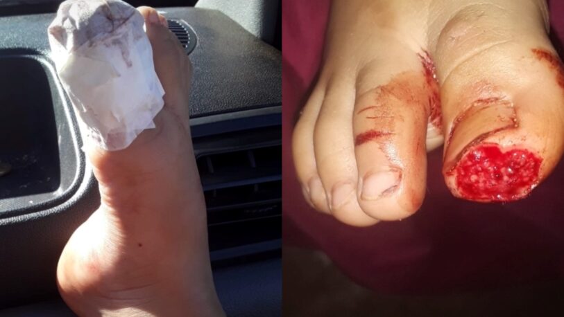 Varios niños fueron atacados por palometas en la playita de Candelaria